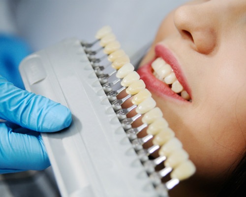 Professional dentist in Malmö for ceramic dental crowns - TandCity