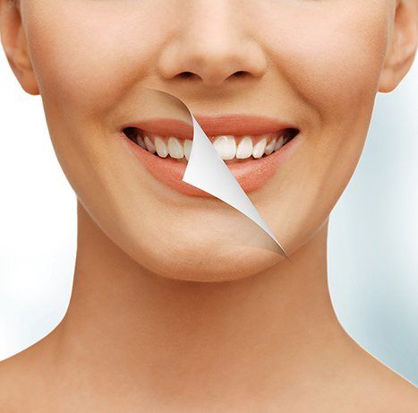 Visit a dentist in Malmö for help with teeth whitening - TandCity