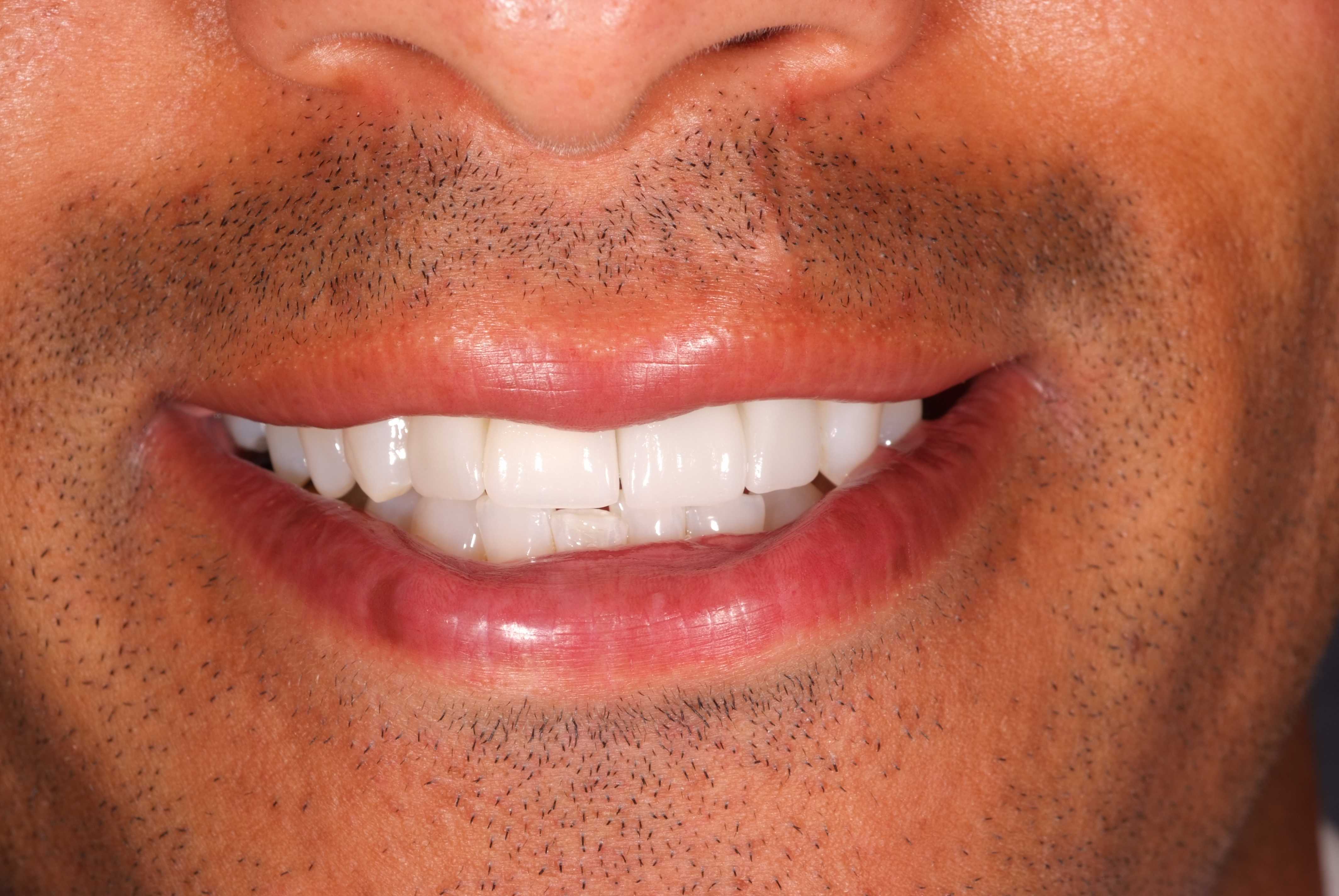 Smile-Styling after